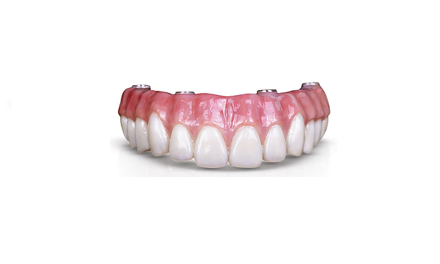 Partial Dentures Leamington