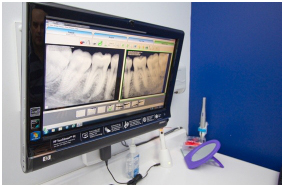 a digital x ray of a patients mouth with the molars present