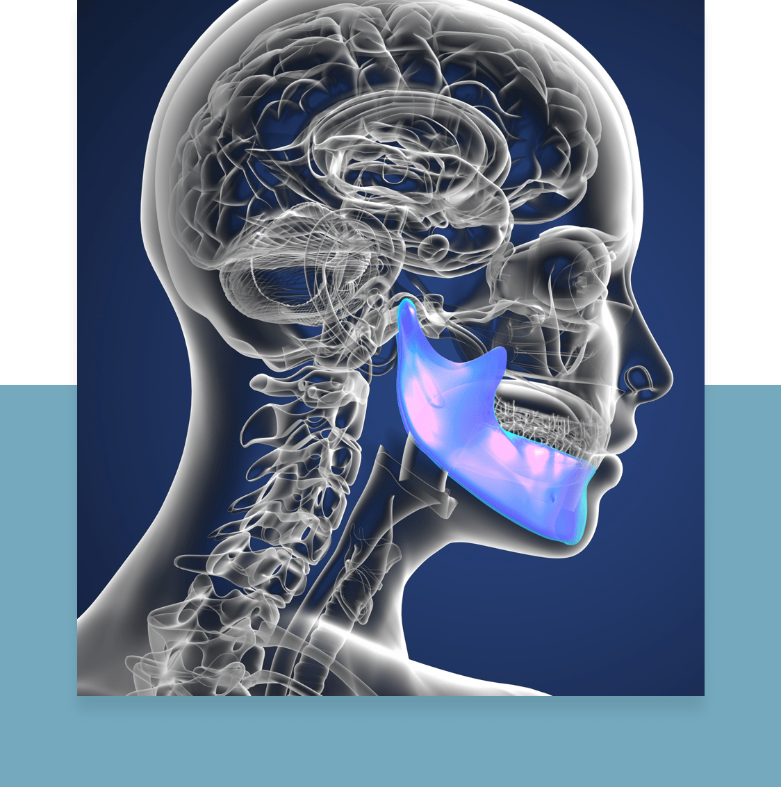Bone Loss Durham Dental Solutions Dr. Bishara