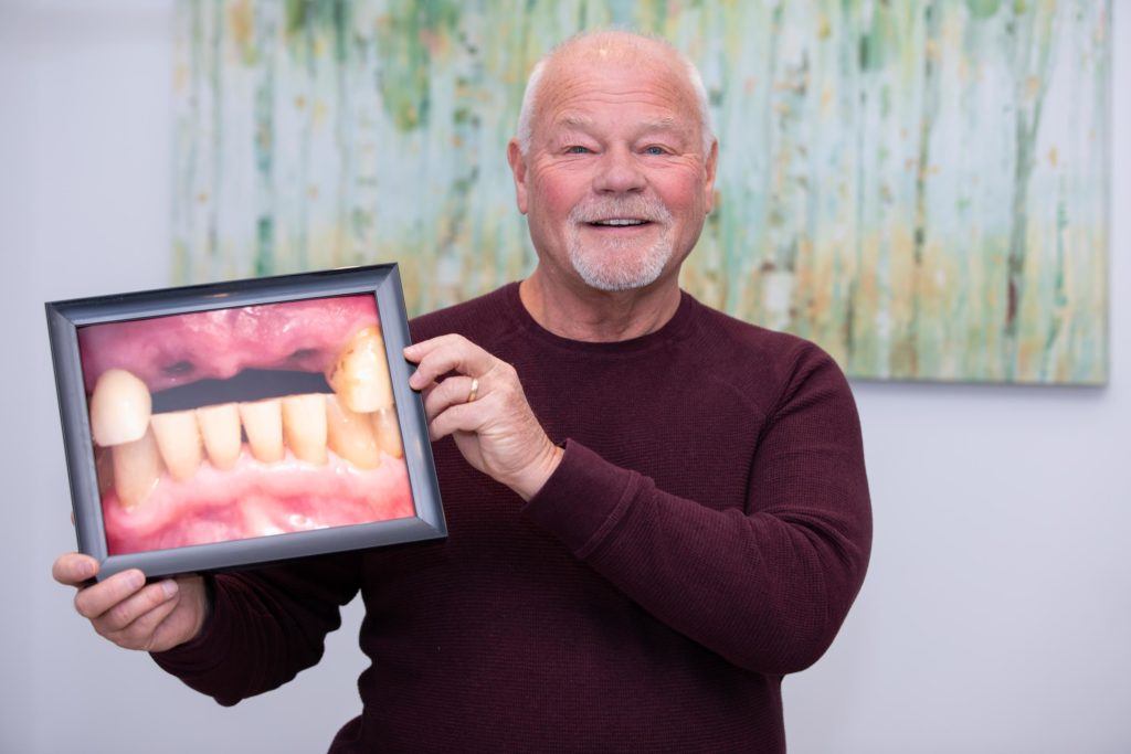 Durham Dental Solutions dental implant patient Durham Dental Solutions