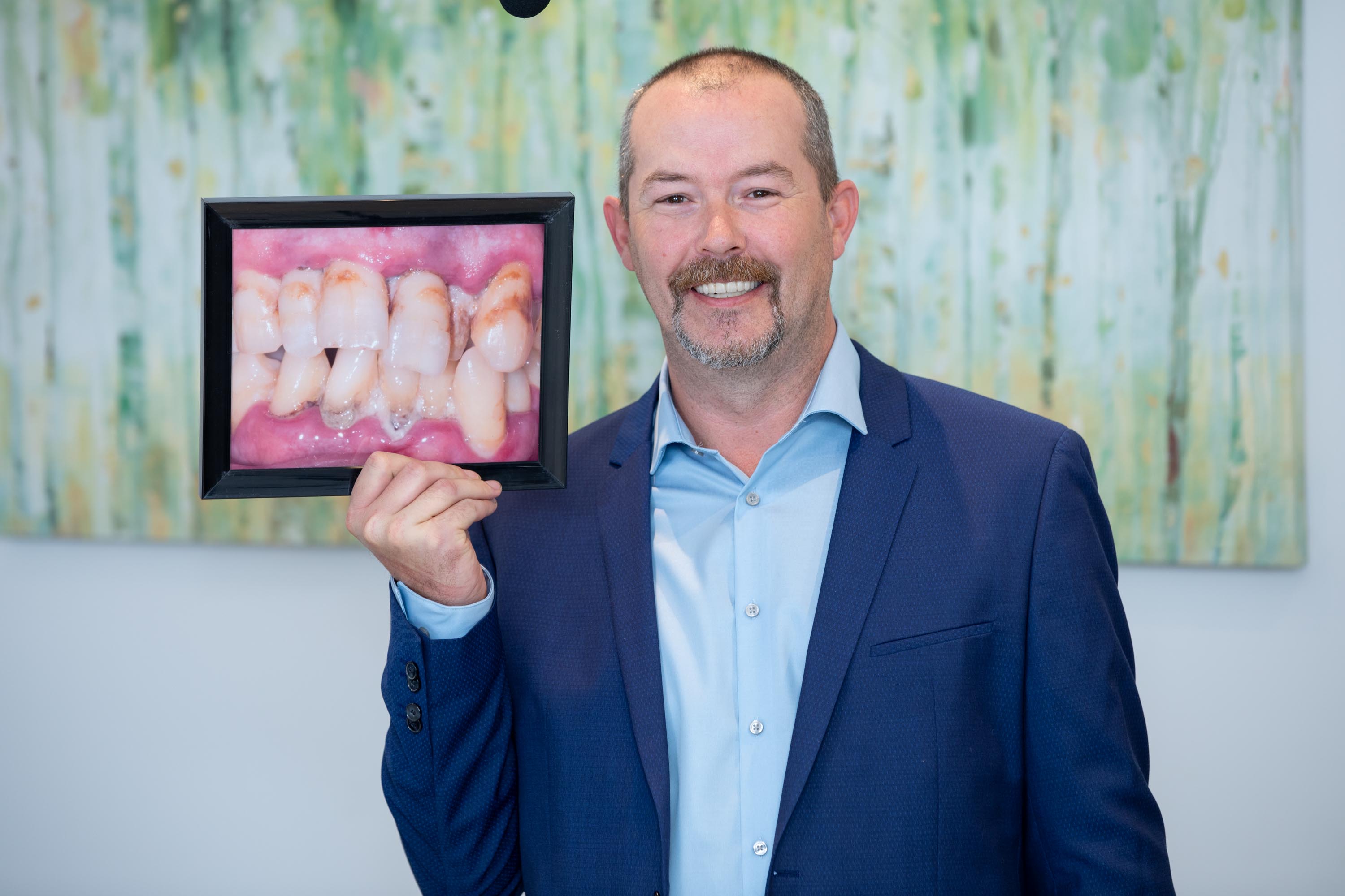 Full arch dental implants Durham Dental Solutions