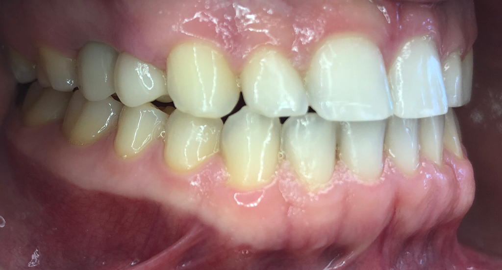 Smile Gallery Durham Dental Solutions