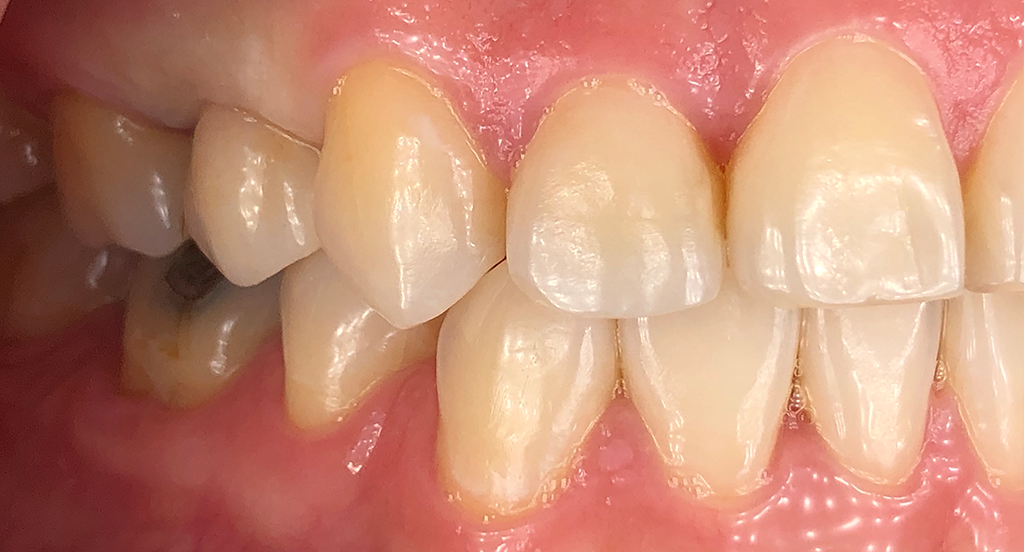 Smile Gallery Durham Dental Solutions