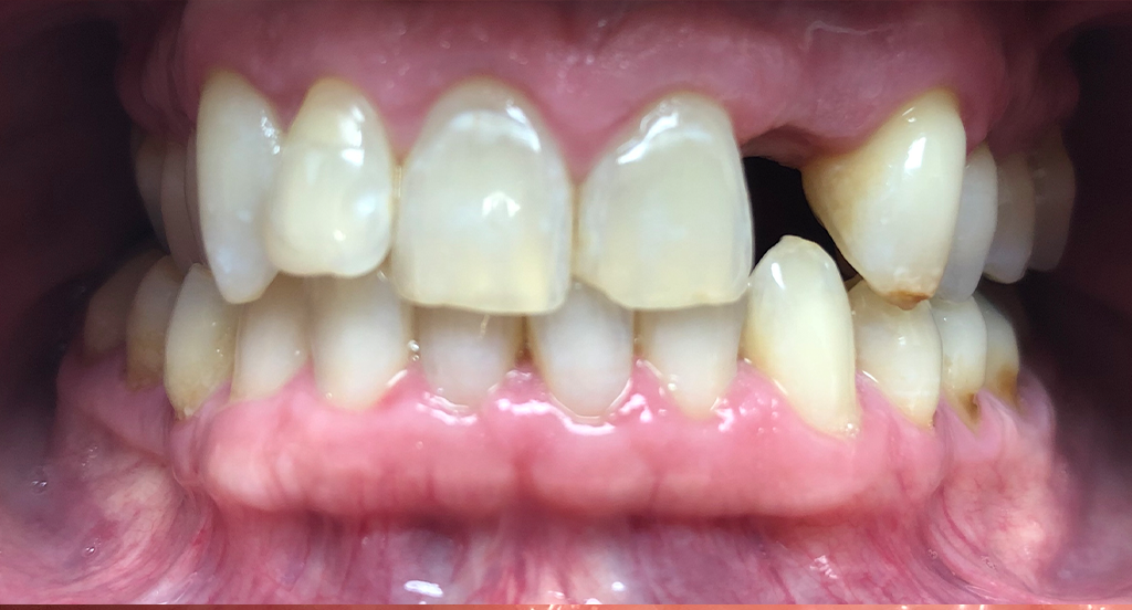 Smile Gallery Durham Dental Solutions