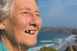 a woman smiling showing her missing teeth with the ocean and rocky shores in the background