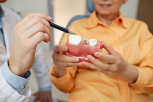 IMG META Closeup of unrecognizable dentist pointing at tooth model while explaining dental implant surgery to patient in clinic, discussing the dental implant treatment process