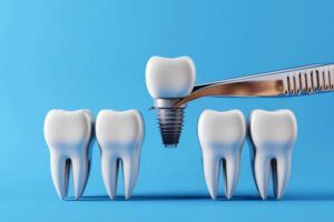 Dental teeth implants and Healthy white teeths. Oral health and dental inspection teeth.