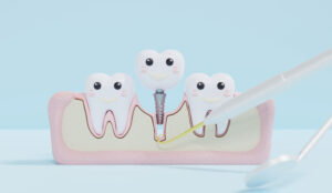 A cross-section of a jawbone with a dental implant being inserted. Cartoon teeth and dental tools are shown. 3d render.