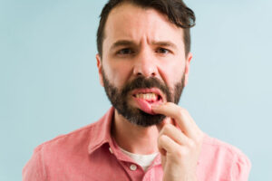 A man lifting his lip to reveal inflamed gums, suggesting symptoms of gum disease, such as redness or swelling, which may require dental attention.