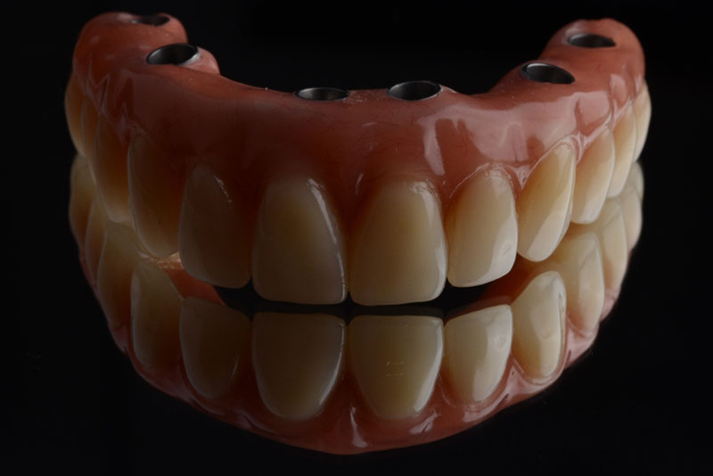 Full arch dental implant prosthesis with realistic artificial teeth and gum base on a reflective black surface.