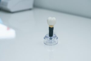 Dentist discussing implant removal process with patient in clinic