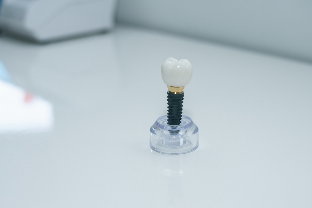 Dentist discussing implant removal process with patient in clinic